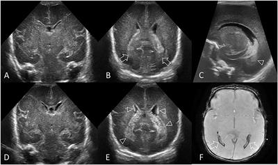 Frontiers | Consensus Approach for Standardizing the Screening and